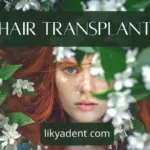 Hair Transplant: Restoring Natural Hair Growth