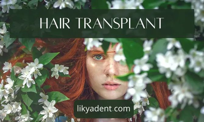 Hair Transplant: Restoring Natural Hair Growth